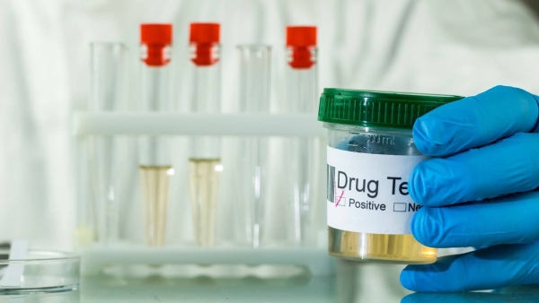 a jar with urine analysis for a drug test